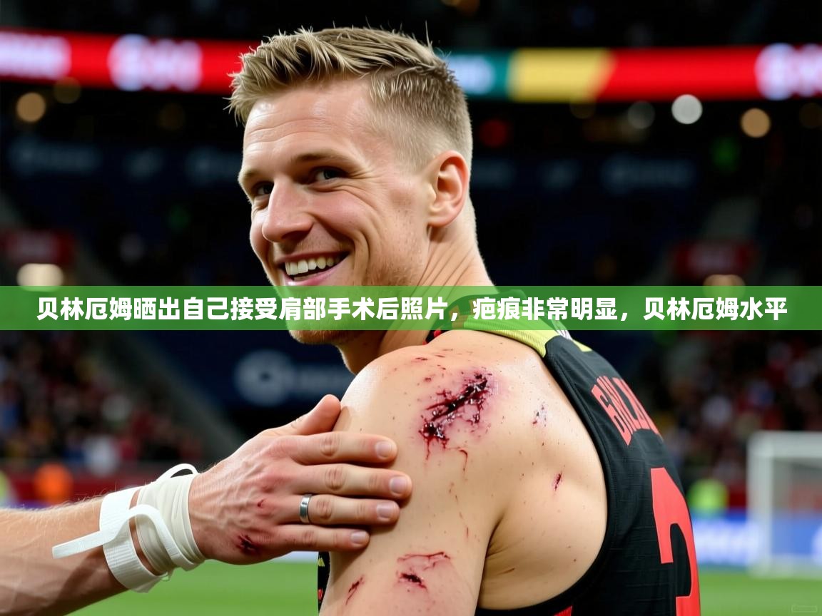 2025米兰体育平台登录入口贝林厄姆晒出自己接受肩部手术后照片,疤痕非常明显,贝林厄姆水平 第1张